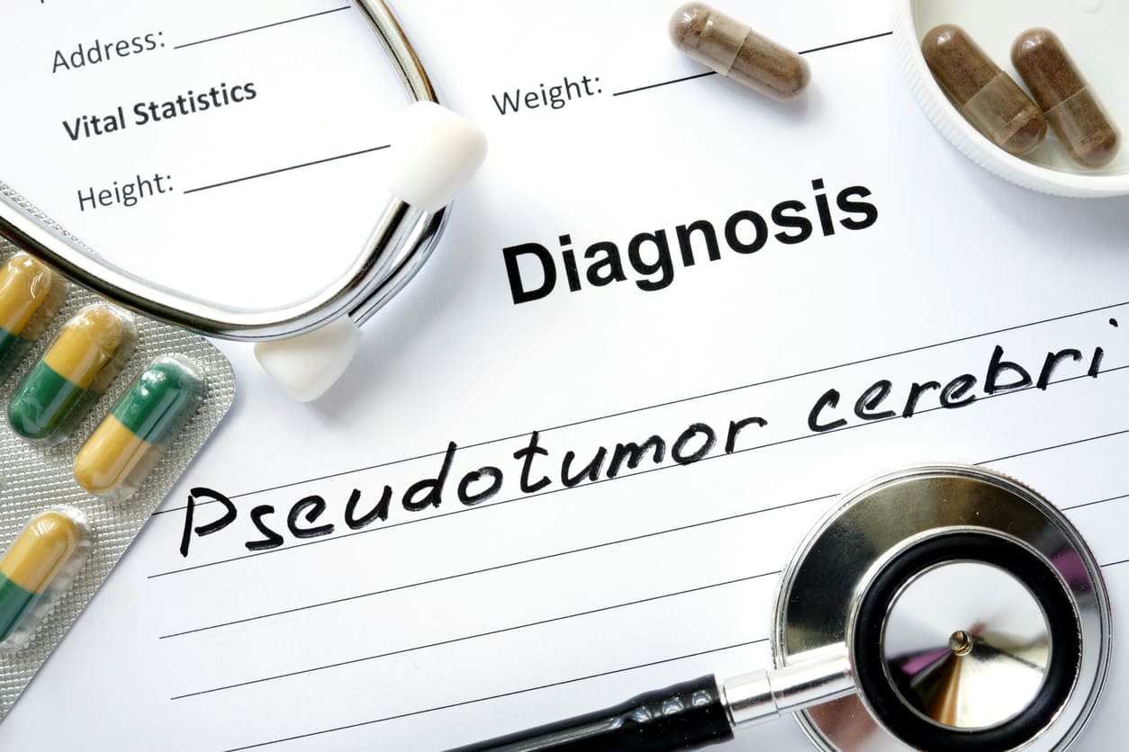 Diagnosis Pseudotumor cerebri, pills and stethoscope.